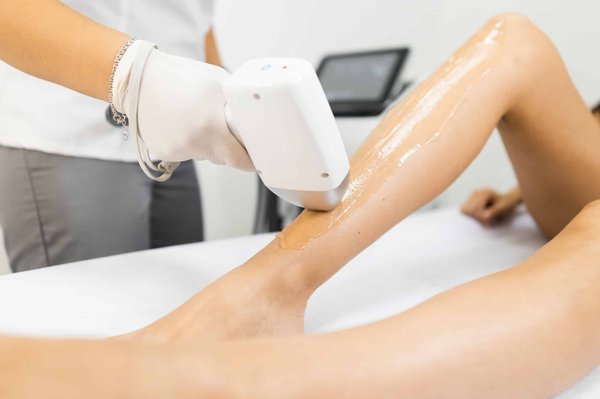 Epilation laser : les préparations nécessaires avant et après la séance